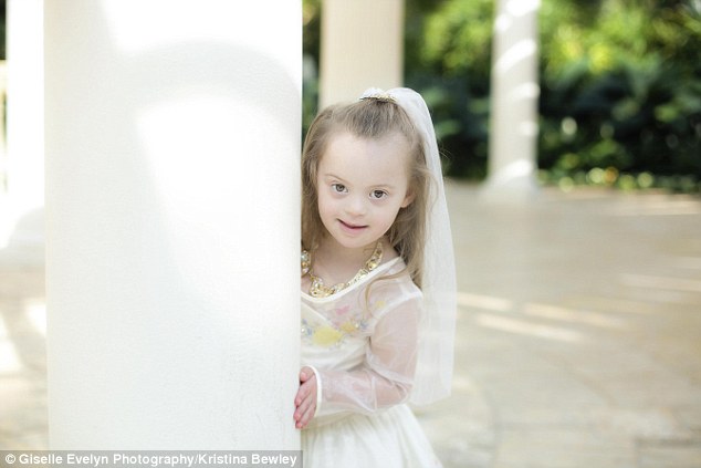 جيزيل طفلة تعاني من متلازمة داون تصبح أميرة
