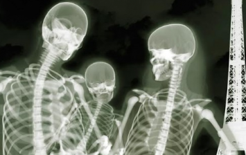 X-Ray Artworks