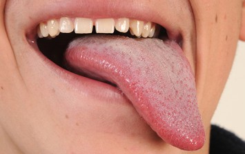 tongue