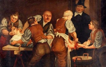 Deadly Facts About Victorian Surgery