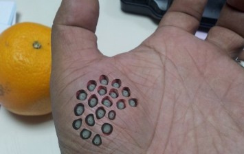 Trypophobia