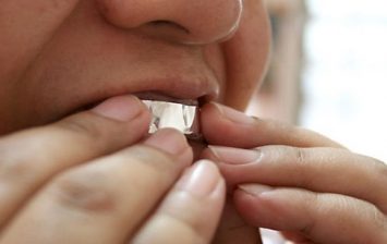 Aluminum Foil on Your Teeth