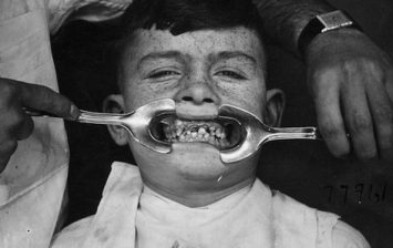 Creepy dental instruments