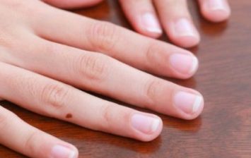 Fingernails to Turn White