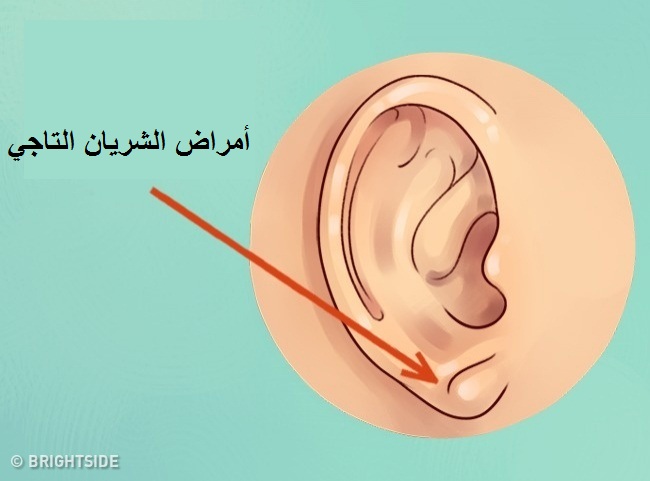 أذن الإنسان 