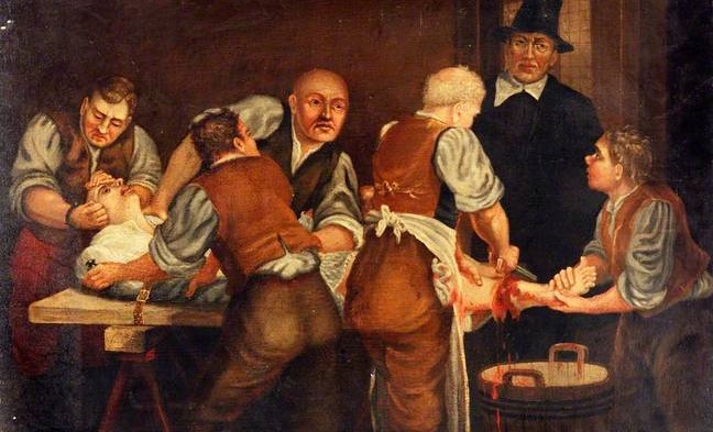 Deadly Facts About Victorian Surgery