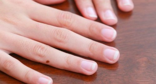 Fingernails to Turn White
